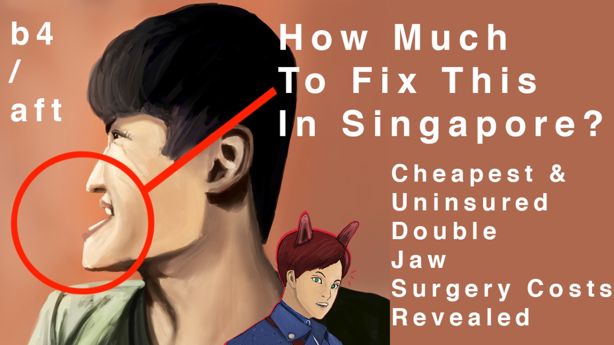 【b4/aft – Art Project】Singapore Double Jaw Surgery【Cheapest & Uninsured – Full Costs】